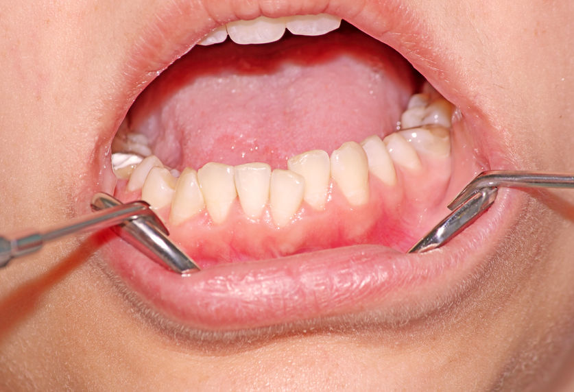 Las causas más frecuentes por las que acudimos al dentista