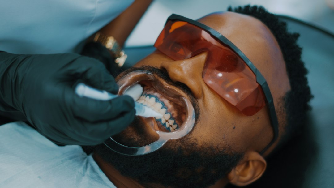 ¿El blanqueamiento dental estropea el esmalte? Lo que hace y lo que no