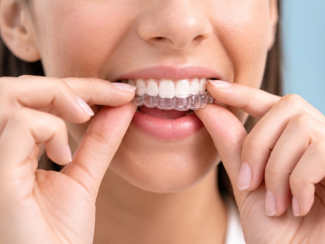 Se me están moviendo los dientes después de la ortodoncia: el papel de los retenedores