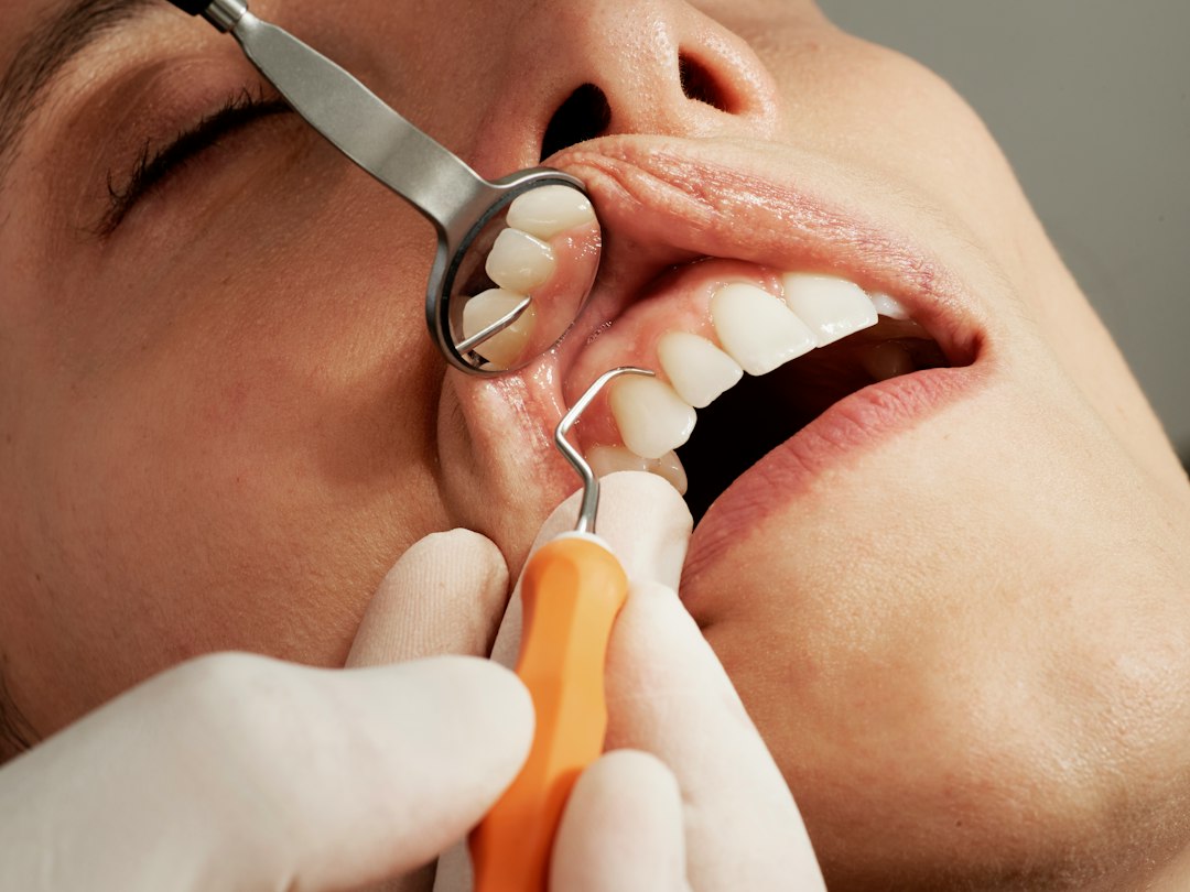 Noto los dientes más largos: qué es la recesión de encías y por qué aparece